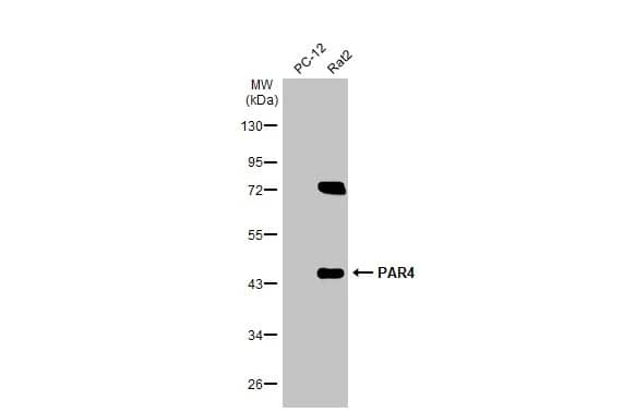 Western Blot: PAWR / PAR4 Antibody [NBP3-13289] - Various whole cell extracts (30 ug) were separated by 10% SDS-PAGE, and the membrane was blotted with PAWR / PAR4 antibody (NBP3-13289) diluted at 1:1000. The HRP-conjugated anti-rabbit IgG antibody  was used to detect the primary antibody.