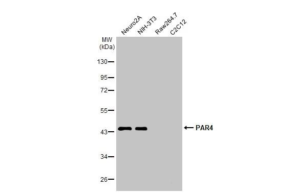 <b>Independent Antibodies Validation. </b>Western Blot: PAWR / PAR4 Antibody [NBP3-13289] - Various whole cell extracts (30 ug) were separated by 10% SDS-PAGE, and the membrane was blotted with PAWR / PAR4 antibody (NBP3-13289) diluted at 1:1000. The HRP-conjugated anti-rabbit IgG antibody  was used to detect the primary antibody.