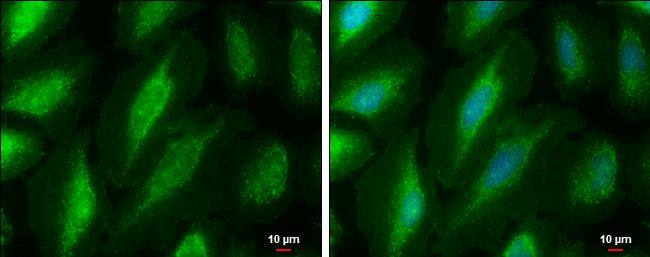 PKC mu antibody detects PKC mu protein at cytoplasm by immunofluorescent analysis.Sample: HeLa cells were fixed in ice-cold MeOH for 5 min.Green: PKC mu protein stained by PKC mu antibody (NBP3-13292) diluted at 1:500.Blue: Hoechst 33342 staining.Scale bar = 10 um. 