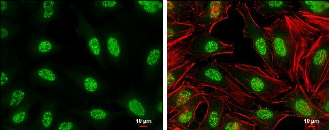 c-Jun (phospho Ser73) antibody detects c-Jun (phospho Ser73) protein at nucleus by immunofluorescent analysis.Sample: HeLa cells were fixed in 4% paraformaldehyde at RT for 15 min.Green: c-Jun (phospho Ser73) stained by c-Jun (phospho Ser73) antibody (NBP3-13304) diluted at 1:500.Red: phalloidin, a cytoskeleton marker, diluted at 1:100.Scale bar= 10um. 