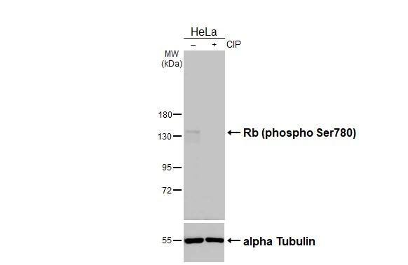 Untreated (-) and treated (+) HeLa whole cell extracts (30 ug) were separated by 7.5% SDS-PAGE, and the membrane was blotted with Rb (phospho Ser780) antibody (NBP3-13308) diluted at 1:1000. The HRP-conjugated anti-rabbit IgG antibody  was used to detect the primary antibody. 