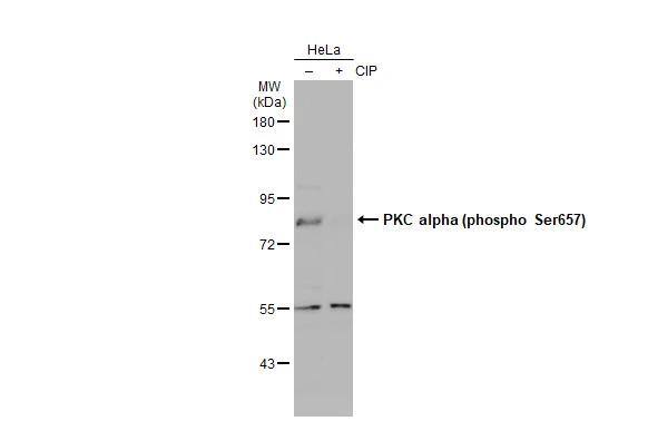 Untreated (-) and treated (+) HeLa whole cell extracts (30 ug) were separated by 7.5% SDS-PAGE, and the membrane was blotted with PKC alpha (phospho Ser657) antibody (NBP3-13311) diluted at 1:500. The HRP-conjugated anti-rabbit IgG antibody  was used to detect the primary antibody, and the signal was developed with Trident ECL plus-Enhanced. 