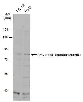 Various whole cell extracts (30 ug) were separated by 7.5% SDS-PAGE, and the membrane was blotted with PKC alpha (phospho Ser657) antibody (NBP3-13311) diluted at 1:500. The HRP-conjugated anti-rabbit IgG antibody  was used to detect the primary antibody. 