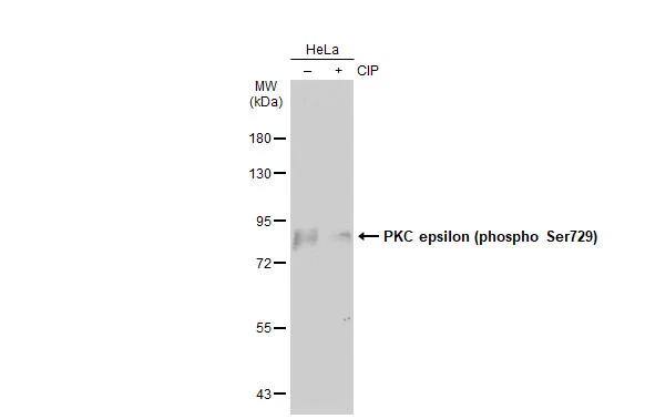 Untreated (-) and treated (+) HeLa whole cell extracts (30 ug) were separated by 7.5% SDS-PAGE, and the membrane was blotted with PKC epsilon (phospho Ser729) antibody (NBP3-13312) diluted at 1:1000. The HRP-conjugated anti-rabbit IgG antibody  was used to detect the primary antibody, and the signal was developed with Trident ECL plus-Enhanced. 