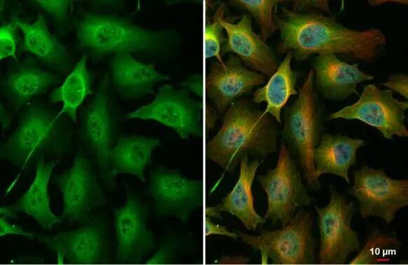 Immunocytochemistry/ Immunofluorescence: PKC zeta [p Thr410] Antibody [NBP3-13313] - PKC zeta antibody detects PKC zeta protein at cytoplasm and nucleus by immunofluorescent analysis.Sample: HeLa cells were fixed in 4% paraformaldehyde at RT for 15 min.Green: PKC zeta stained by PKC zeta antibody (NBP3-13313) diluted at 1:500.Red: alpha Tubulin, a cytoskeleton marker, stained by alpha Tubulin antibody [GT114]  diluted at 1:1000.Blue: Fluoroshield with DAPI .