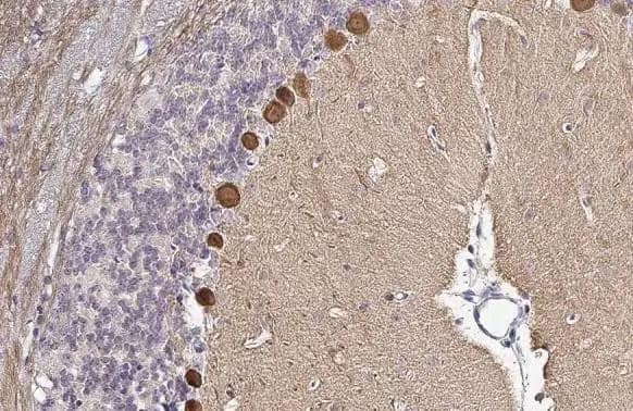 <b>Biological Strategies Validation. </b>Immunohistochemistry-Paraffin: PKC zeta [p Thr410] Antibody [NBP3-13313] - PKC zeta antibody detects PKC zeta protein by immunohistochemical analysis.Sample: Paraffin-embedded mouse cerebellum.PKC zeta stained by PKC zeta antibody (NBP3-13313) diluted at 1:500.Antigen Retrieval: Citrate buffer, pH 6.0, 15 min
