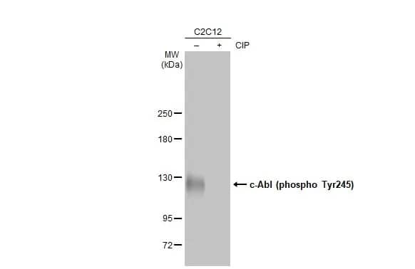 Western Blot: c-Abl [p Tyr245] Antibody [NBP3-13326] - Untreated (-) and treated (+) C2C12 whole cell extracts (30 ug) were separated by 5% SDS-PAGE, and the membrane was blotted with c-Abl antibody (NBP3-13326) diluted at 1:500. The HRP-conjugated anti-rabbit IgG antibody  was used to detect the primary antibody.