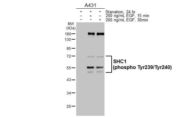 Untreated (-) and treated (+) A431 whole cell extracts (30 ug) were separated by 10% SDS-PAGE, and the membrane was blotted with SHC1 (phospho Tyr239/240) antibody (NBP3-13327) diluted at 1:1000. The HRP-conjugated anti-rabbit IgG antibody  was used to detect the primary antibody. 