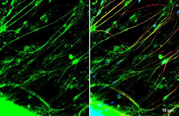 CGRP antibody detects CGRP protein at cytoplasmic vesicles by immunofluorescent analysis.Sample: mouse dorsal root ganglia cells were fixed in 4% paraformaldehyde at RT for 15 min.Green: CGRP stained by CGRP antibody (NBP3-13330) diluted at 1:500.Red: NF-H, an axon marker, stained by NF-H antibody [GT114]  diluted at 1:500.Blue: Fluoroshield with DAPI . 