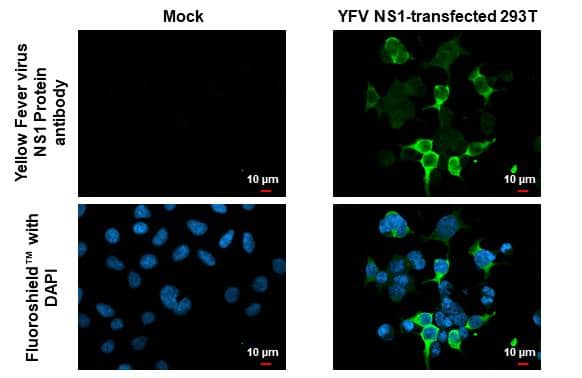 Yellow Fever virus NS1 Protein antibody detects Yellow Fever virus NS1 protein by immunofluorescent analysis.Sample: Mock and transfected 293T cells were fixed in 4% paraformaldehyde at RT for 15 min.Green: Yellow Fever virus NS1 Protein stained by Yellow Fever virus NS1 Protein antibody (NBP3-13335) diluted at 1:500.Blue: Fluoroshield with DAPI . 