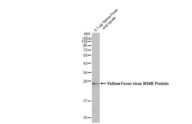 Western Blot: Yellow Fever Virus NS4B Antibody [NBP3-13338] - Yellow Fever viral lysate (0.1 ug) was separated by 12% SDS-PAGE, and the membrane was blotted with Yellow Fever Virus NS4B antibody (NBP3-13338) diluted at 1:1000. The HRP-conjugated anti-rabbit IgG antibody  was used to detect the primary antibody.