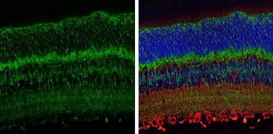 EAAT2 antibody detects EAAT2 protein at cell membrane by immunohistochemical analysis.Sample: Paraffin-embedded mouse eye.Green: EAAT2 stained by EAAT2 antibody (NBP3-13348) diluted at 1:250.Red: beta Tubulin 3/ Tuj1, a cytoplasm marker, stained by beta Tubulin 3/ Tuj1 antibody [GT1338]  diluted at 1:500.Blue: Fluoroshield with DAPI . Antigen Retrieval: Citrate buffer, pH 6.0, 15 min 