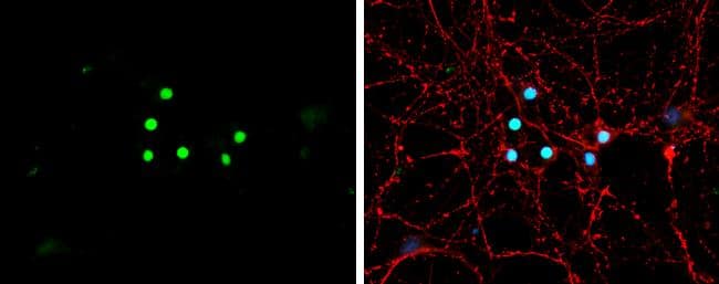 NeuroD1 antibody detects NeuroD1 protein by immunofluorescent analysis.Sample: DIV9 rat E18 primary hippocampal neuron cells were fixed in 4% paraformaldehyde at RT for 15 min.Green: NeuroD1 stained by NeuroD1 antibody (NBP3-13350) diluted at 1:500.Red: alpha Tubulin, stained by alpha Tubulin antibody [GT114]  diluted at 1:500.Blue: Fluoroshield with DAPI . 
