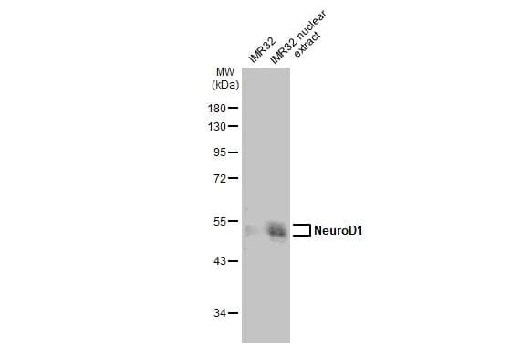 IMR32 whole cell and nuclear extracts (30 ug) were separated by 10% SDS-PAGE, and the membrane was blotted with NeuroD1 antibody (NBP3-13350) diluted at 1:1000. The HRP-conjugated anti-rabbit IgG antibody  was used to detect the primary antibody. 