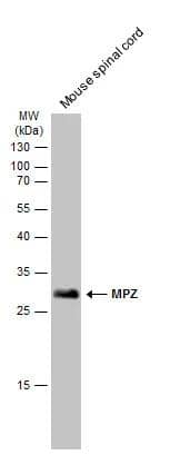 Mouse tissue extract (50 ug) was separated by 12% SDS-PAGE, and the membrane was blotted with MPZ antibody (NBP3-13351) diluted at 1:1000. The HRP-conjugated anti-rabbit IgG antibody  was used to detect the primary antibody. 