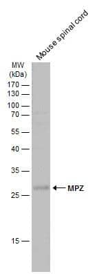 Mouse tissue extract (50 ug) was separated by 12% SDS-PAGE, and the membrane was blotted with MPZ antibody (NBP3-13353) diluted at 1:1000. The HRP-conjugated anti-rabbit IgG antibody  was used to detect the primary antibody. 