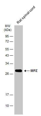 Rat tissue extract (50 ug) was separated by 12% SDS-PAGE, and the membrane was blotted with MPZ antibody (NBP3-13353) diluted at 1:500. The HRP-conjugated anti-rabbit IgG antibody  was used to detect the primary antibody. 