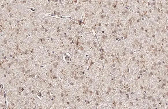 Immunohistochemistry-Paraffin: TMEM119 Antibody [NBP3-13355] - TMEM119 antibody detects TMEM119 protein at cytoplasm by immunohistochemical analysis.Sample: Paraffin-embedded rat brain.TMEM119 stained by TMEM119 antibody (NBP3-13355) diluted at 1:500.Antigen Retrieval: Citrate buffer, pH 6.0, 15 min