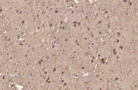 Immunohistochemistry-Paraffin: TMEM119 Antibody [NBP3-13355] - TMEM119 antibody detects TMEM119 protein at cell membrane and cytoplasm by immunohistochemical analysis.Sample: Paraffin-embedded mouse brain.TMEM119 stained by TMEM119 antibody (NBP3-13355) diluted at 1:500.Antigen Retrieval: Citrate buffer, pH 6.0, 15 min