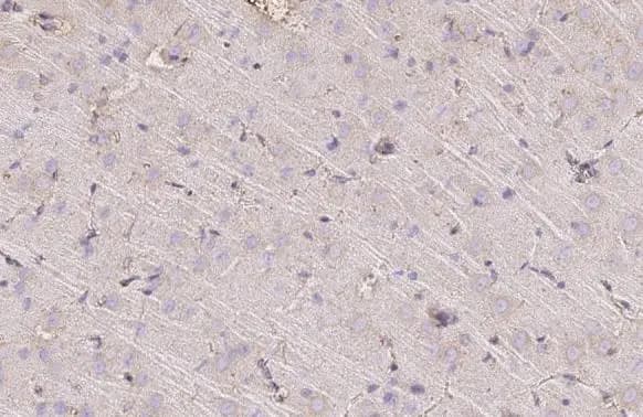 Immunohistochemistry-Paraffin: TMEM119 Antibody [NBP3-13355] - TMEM119 antibody detects TMEM119 protein at cell membrane and cytoplasm by immunohistochemical analysis.Sample: Paraffin-embedded rat brain.TMEM119 stained by TMEM119 antibody (NBP3-13355) diluted at 1:500.Antigen Retrieval: Citrate buffer, pH 6.0, 15 min