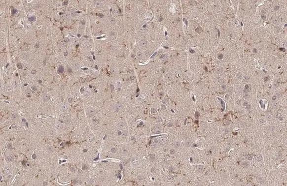 TMEM119 antibody detects TMEM119 protein at microglia cells by immunohistochemical analysis.Sample: Paraffin-embedded rat brain.TMEM119 stained by TMEM119 antibody (NBP3-13355) diluted at 1:500.Antigen Retrieval: Citrate buffer, pH 6.0, 15 min 