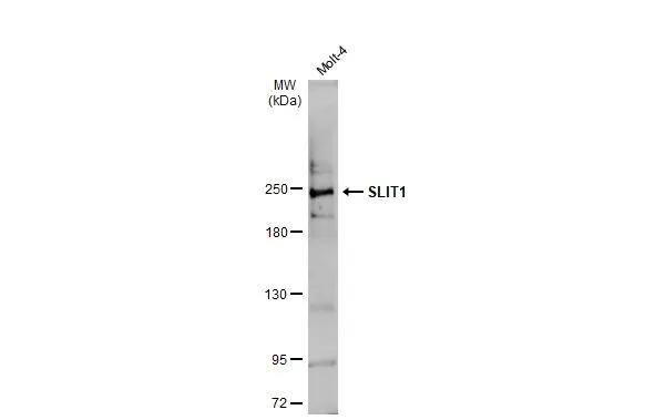 Whole cell extract (30 ug) was separated by 5% SDS-PAGE, and the membrane was blotted with SLIT1 antibody (NBP3-13365) diluted at 1:1000. The HRP-conjugated anti-rabbit IgG antibody  was used to detect the primary antibody. 
