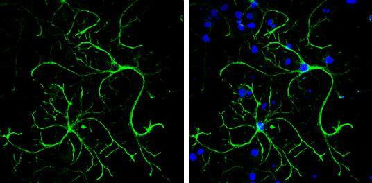 Immunocytochemistry/ Immunofluorescence alpha Desmuslin Antibody