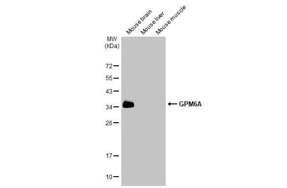 Various tissue extracts (30 ug) were separated by 12% SDS-PAGE, and the membrane was blotted with GPM6A antibody (NBP3-13410) diluted at 1:10000. The HRP-conjugated anti-rabbit IgG antibody  was used to detect the primary antibody. 