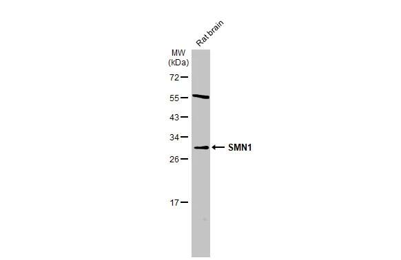 Western Blot: SMN Antibody [NBP3-13414] - Rat tissue extract (50 ug) was separated by 12% SDS-PAGE, and the membrane was blotted with SMN antibody (NBP3-13414) diluted at 1:500. The HRP-conjugated anti-rabbit IgG antibody  was used to detect the primary antibody.