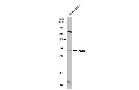 Western Blot: SMN Antibody [NBP3-13414] - Mouse tissue extract (50 ug) was separated by 12% SDS-PAGE, and the membrane was blotted with SMN (NBP3-13414) diluted at 1:1000. The HRP-conjugated anti-rabbit IgG antibody  was used to detect the primary antibody.