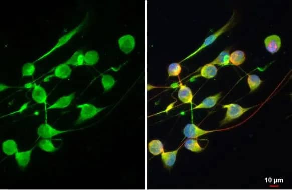 Immunocytochemistry/ Immunofluorescence: ANKRD16 Antibody [NBP3-13416] - ANKRD16 antibody detects ANKRD16 protein at cytoplasm by immunofluorescent analysis.Sample: U87-MG cells were fixed in 4% paraformaldehyde at RT for 15 min.Green: ANKRD16 stained by ANKRD16 antibody (NBP3-13416) diluted at 1:500.Red: alpha Tubulin, a cytoskeleton marker, stained by alpha Tubulin antibody [GT114]  diluted at 1:1000.Blue: Fluoroshield with DAPI .