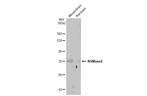 Western Blot: SMPD3/NSMase2 Antibody [NBP3-13444] - Various tissue extracts (50 ug) were separated by 7.5% SDS-PAGE, and the membrane was blotted with SMPD3/NSMase2 antibody (NBP3-13444) diluted at 1:1500. The HRP-conjugated anti-rabbit IgG antibody  was used to detect the primary antibody.