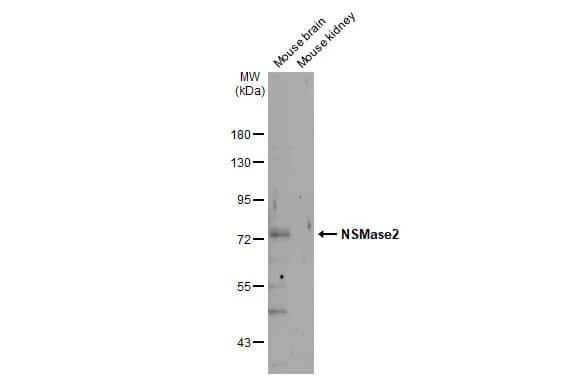 Western Blot: SMPD3/NSMase2 Antibody [NBP3-13444] - Various tissue extracts (50 ug) were separated by 7.5% SDS-PAGE, and the membrane was blotted with SMPD3/NSMase2 antibody (NBP3-13444) diluted at 1:750. The HRP-conjugated anti-rabbit IgG antibody  was used to detect the primary antibody.