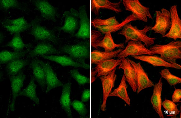 Immunocytochemistry/ Immunofluorescence: RRAGA Antibody [NBP3-13446] - RRAGA antibody detects RRAGA protein at cytoplasm and nucleus by immunofluorescent analysis.Sample: HeLa cells were fixed in 4% paraformaldehyde at RT for 15 min.Green: RRAGA stained by RRAGA antibody (NBP3-13446) diluted at 1:500.Red: alpha Tubulin, a cytoskeleton marker, stained by alpha Tubulin antibody [GT114]  diluted at 1:1000.Scale bar= 10um.