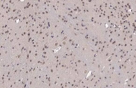 Immunohistochemistry-Paraffin: RRAGA Antibody [NBP3-13446] - RRAGA antibody detects RRAGA protein at cytoplasm and nucleus by immunohistochemical analysis.Sample: Paraffin-embedded mouse brain.RRAGA stained by RRAGA antibody (NBP3-13446) diluted at 1:500.Antigen Retrieval: Citrate buffer, pH 6.0, 15 min