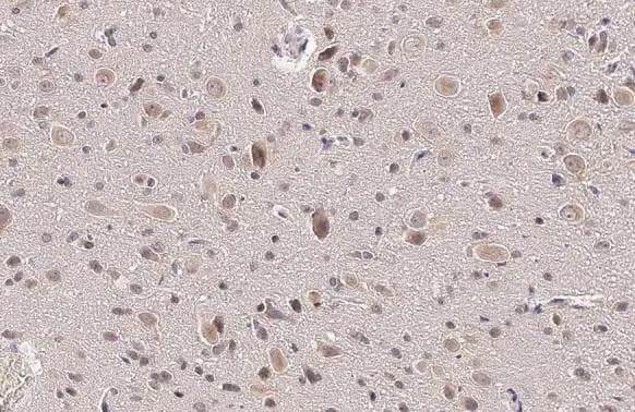 Immunohistochemistry-Paraffin: RRAGA Antibody [NBP3-13446] - RRAGA antibody detects RRAGA protein at cytoplasm and nucleus by immunohistochemical analysis.Sample: Paraffin-embedded rat brain.RRAGA stained by RRAGA antibody (NBP3-13446) diluted at 1:500.Antigen Retrieval: Citrate buffer, pH 6.0, 15 min