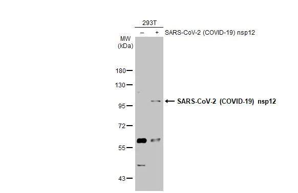 Non-transfected (-) and transfected (+) 293T whole cell extracts (30 ug) were separated by 7.5% SDS-PAGE, and the membrane was blotted with SARS-CoV-2 (COVID-19) nsp12 antibody (NBP3-13456) diluted at 1:5000. The HRP-conjugated anti-rabbit IgG antibody  was used to detect the primary antibody. 