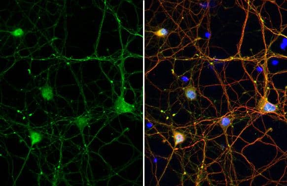 Tau (phospho Thr217) antibody detects Tau (phospho Thr217) protein at nucleus and cytoskeleton by immunofluorescent analysis.Sample: DIV9 rat E18 primary cortical neuron cells were fixed in 4% paraformaldehyde at RT for 15 min.Green: Tau (phospho Thr217) stained by Tau (phospho Thr217) antibody (NBP3-13481) diluted at 1:250.Red: Tau, an axon marker, stained by Tau antibody [GT287]  diluted at 1:500.Blue: Fluoroshield with DAPI . 