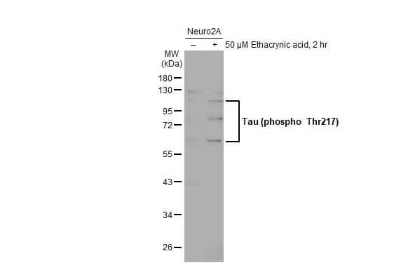 Untreated (-) and treated (+) Neuro2A whole cell extracts (30 ug) were separated by 10% SDS-PAGE, and the membrane was blotted with Tau (phospho Thr217) antibody (NBP3-13481) diluted at 1:3000. The HRP-conjugated anti-rabbit IgG antibody  was used to detect the primary antibody. 