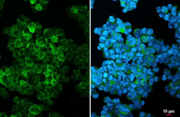 Immunocytochemistry/ Immunofluorescence: HLA DQA1 Antibody [NBP3-13483] - HLA DQA1 antibody detects HLA DQA1 protein at cell membrane by immunofluorescent analysis.Sample: Raji cells were fixed in 4% paraformaldehyde at RT for 15 min.Green: HLA DQA1 stained by HLA DQA1 antibody (NBP3-13483) diluted at 1:500.Blue: Fluoroshield with DAPI .