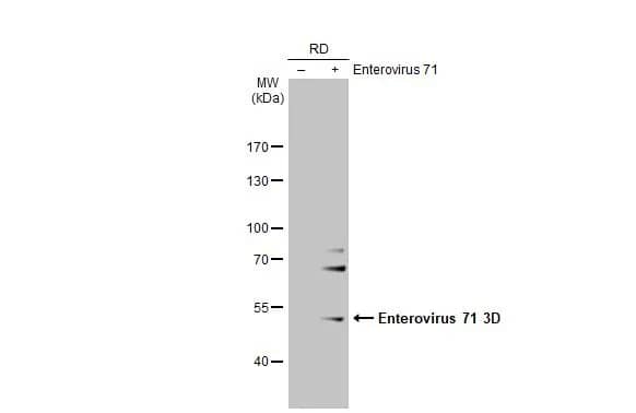 Western Blot: Enterovirus 71 3D Antibody (4) [NBP3-13502] - Non-infected (-) and infected (+) RD whole cell extracts (30 ug) were separated by 7.5% SDS-PAGE, and the membrane was blotted with Enterovirus 71 3D antibody [4] (NBP3-13502) diluted at 1:5000. The HRP-conjugated anti-mouse IgG antibody  was used to detect the primary antibody.
