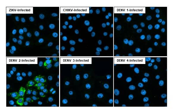 Immunocytochemistry/ Immunofluorescence Dengue Virus NS1 protein Antibody (GT4212) - Azide and BSA Free