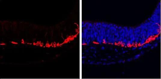 beta Tubulin 3/ Tuj1 antibody [GT1338] detects beta Tubulin 3/ Tuj1 protein at cytoplasm by immunohistochemical analysis.Sample: Paraffin-embedded mouse E10.5 embryo.Red: beta Tubulin 3/ Tuj1 stained by beta Tubulin 3/ Tuj1 antibody [GT1338] (NBP3-13505) diluted at 1:500.Blue: Fluoroshield with DAPI . 