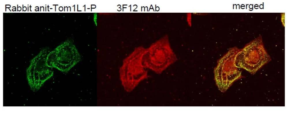 ICC/IF analysis of EGF stimulated A431 cells using NBP3-13511 TOM1L1 antibody [3F12].Red : Primary antibodyGreen : Polyclonal TOM1L1 antibodyYellow : Merged color of red and green 