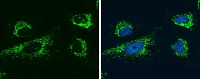 Glutaminase C antibody [GT1075] detects Glutaminase C protein at mitochondria by immunofluorescent analysis.Sample: HeLa cells were fixed in 4% paraformaldehyde at RT for 15 min.Green: Glutaminase C protein stained by Glutaminase C antibody [GT1075] (NBP3-13512) diluted at 1:400.Blue: Hoechst 33342 staining. 