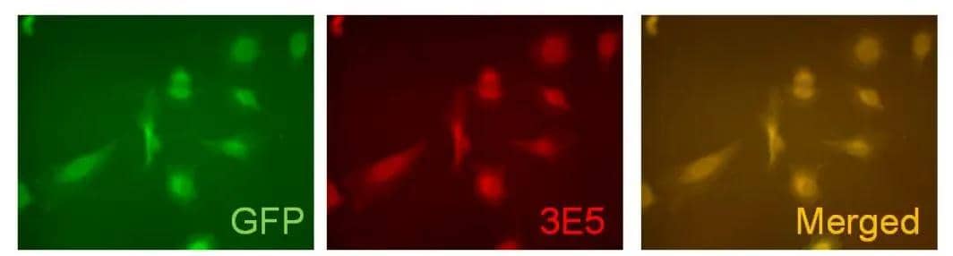 ICC/IF analysis of pLEGFP-C1-hV5p transfected HeLa cells using NBP3-13515 VAMP5 antibody [3E5].Red : Primary antibody 
