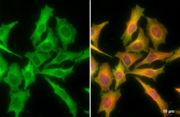 Immunocytochemistry/ Immunofluorescence: CXCL16 Antibody (GT516) [NBP3-13519] - CXCL16 antibody [GT516] detects CXCL16 protein at cytoplasm by immunofluorescent analysis.Sample: HeLa cells were fixed in 4% paraformaldehyde at RT for 15 min.Green: CXCL16 stained by CXCL16 antibody [GT516] (NBP3-13519) diluted at 1:500.Red: beta Tubulin, a cytoskeleton marker, stained by beta Tubulin antibody  diluted at 1:1000.Blue: Fluoroshield with DAPI .Scale bar= 10um.