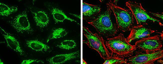 SDHA antibody [GT20710] detects SDHA protein at mitochondria by immunofluorescent analysis.Sample: HeLa cells were fixed in 4% paraformaldehyde at RT for 15 min.Green: SDHA protein stained by SDHA antibody [GT20710] (NBP3-13522) diluted at 1:500.Red: Phalloidin, a cytoskeleton marker, diluted at 1:100.Blue: Hoechst 33342 staining. 