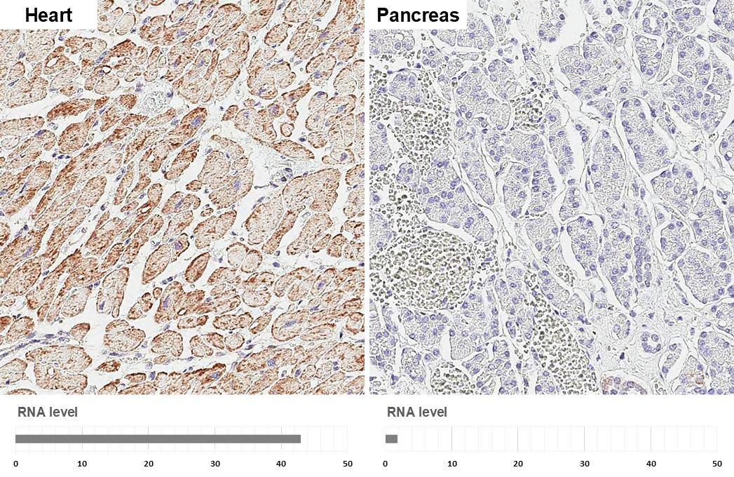 SDHA antibody [GT20710] detects SDHA protein by immunohistochemical analysis.Sample: Paraffin-embedded human tissues.SDHA stained by SDHA antibody [GT20710] (NBP3-13522) diluted at 1:200.Antigen Retrieval: Citrate buffer, pH 6.0, 15 min 