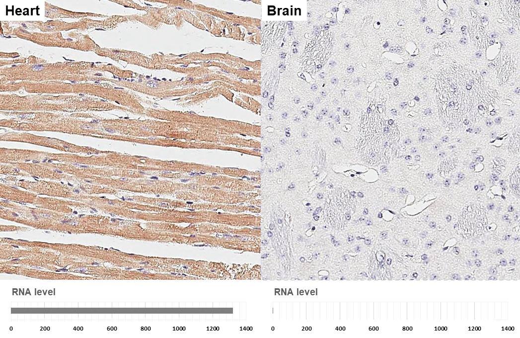 MYH6 antibody [GT5612] detects MYH6 protein by immunohistochemical analysis.Sample: Paraffin-embedded mouse tissues.MYH6 stained by MYH6 antibody [GT5612] (NBP3-13524) diluted at 1:200.Antigen Retrieval: Citrate buffer, pH 6.0, 15 min 